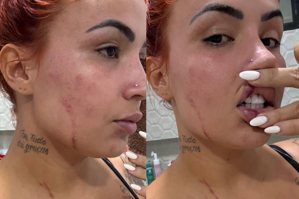 Preso suspeito de tentar matar influencer 'Ruivão' em João Pessoa