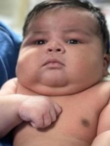 Bebê de 6,5 kg nasce de parto normal com complicação em Colatina